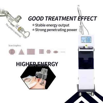 آلة الليزر CO2 كسور مع أنبوب RF KES